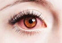 बरसात के मौसम में आंखों का रखें विशेष ख्याल नहीं तो आ सकती है ये समस्या बरसात के मौसम में आंखों का रखें विशेष ख्याल नहीं तो आ सकती है ये समस्या