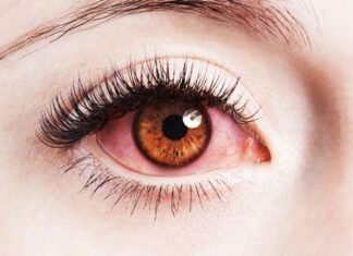 बरसात के मौसम में आंखों का रखें विशेष ख्याल नहीं तो आ सकती है ये समस्या बरसात के मौसम में आंखों का रखें विशेष ख्याल नहीं तो आ सकती है ये समस्या